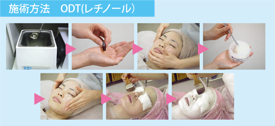 レチノールを使用したODTパック実技セミナー